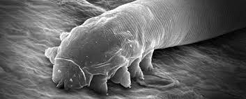 Image result for Demodex brevis