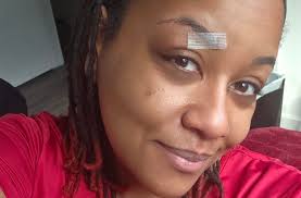 Personal experience with a broken finger and hospital visit