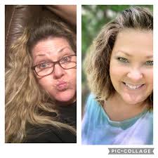 My hair has started falling out—when I had Covid- I was