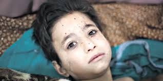 It released a statement saying that the bombing cut off the oxygen supply to a room where babies were being cared for and that one died. Brisbane Parish Praying For Syria After Seeing Images Of Children Affected By Bomb Blast The Catholic Leaderthe Catholic Leader