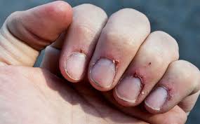 My Cuticle Are So Bad Acrylic Nails Reddit New Expression Nails You should expect your acrylic nails to last for as long as 1 to 2 weeks after getting them on.