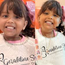 Diseño de Sonrisa/Armonizacion Orofacial/Protesis maxilofaciales