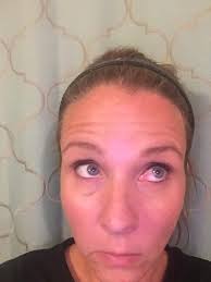 BloodshotEyesInDUICases 👀🚔 What do bloodshot eyes really mean in a DUI  case? Let's clear the air and address this common concern. At Cromey Law, I  understand how stressful facing a DUI charge