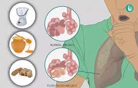 Home Remedies To Get Rid Of Mucus