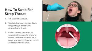 How To Swab For Strep Throat Video