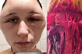 Warnung Bevor Sie Ihre Haare Farben Sollten Sie Das Lesen Is Your Hair Dye Worth A Cancer Risk Netzfrauen Netzfrauen
