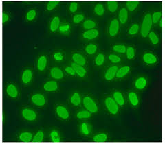 Image result for ANA Staining Pattern