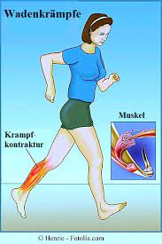 Muskelkrampfe In Den Beinen Symptome Und Therapie