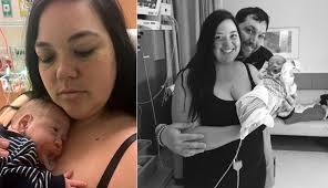 By linda carroll pregnant women have long been told that when their water breaks, they should be ready to deliver the baby within 24 hours to avoid infection. This Woman S Water Broke At 17 Weeks And She Still Was Able To Give Birth To A Healthy Baby Self