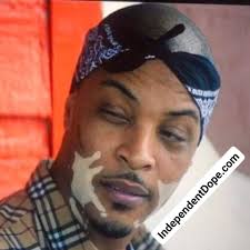 Ti with the vitiligo was wild 🤯 🤯 🤯