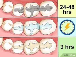 It usually only takes 8 to 10 hours for your tooth to stop hurting after you have a cavity filled. How To Care For A Tooth Filling 14 Steps With Pictures