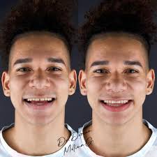 Somos especialistas dentales! ☎️2470-2932. 📱8470-2932