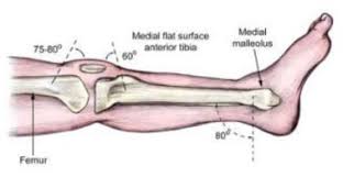 Image result for Intraosseous Access