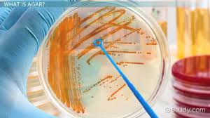 Columbia cna agar base is used for the selective. What Is The Role Of Sheep Blood Sugar In Cna Agar Study Com