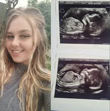 My pregnant daughter, 21, went for a 30-minute lie down and never woke up