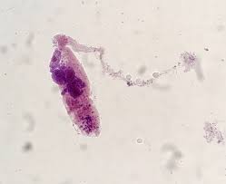 Image result for Cylindropsis