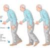 Here's how to treat tremors and when you should see a doctor. 3