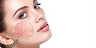 Since 2016 vanish laser clinic has been helping thousands of people be the best version of themselves. Laser Skin Treatments Jardines Face And Body Clinic