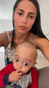 Craniosténose Morgane