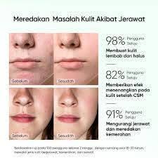 Skintific Pure Centella Acne Calming Toner 80ml Harga Rp 121.000,- Disc 10%  jadi Rp 108.900,- Toner dengan kandungan Centella Asiatica, Ectoin dan  Ceramide yang berfokus untuk menenangkan kulit berjerawat serta membantu  mengontrol