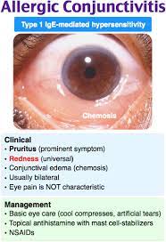 Allergic Conjunctivitis Medical Mnemonics Nurse Practioner Nursing Mnemonics