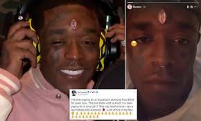 Their rarity means pink diamonds are exceedingly valuable. Rapper Lil Uzi Vert Gets 11 Karat Pink Diamond Worth Upwards Of 24million Pierced To His Forehead
