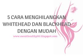 Untuk menghilangkan komedo dengan putih telur, kocok putih telur hingga mengembang selama kurang lebih 10 menit dan. Blog Safeni Feni 5 Cara Menghilangkan Whitehead Dan Blackhead Dengan Mudah