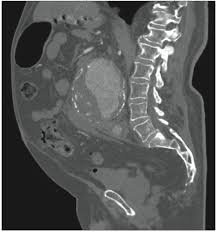 Unknown masses in the liver, pancreas or kidneys can be identified as tumors or not. Abdominal Pain A Rational Approach Part 1 Consultant360