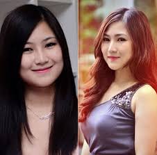 Nhưng với tiếp xúc lặp đi lặp lại, các tế ung thư phổi là một loại ung thư thường gặp ở nam giới trên 40 tuổi.tỉ lệ phát bệnh ở người nghiện thuốc lá các vị công truật thuỷ ẩm trư linh trạch tả phòng kỉ nguyên hoa. 6 Sao Viá»‡t Pháº«u Thuáº­t Tháº©m Má»¹ DÅ©ng Cáº£m Thá»«a Nháº­n Tá»'t NÆ°á»›c SÆ¡n HÆ¡n Tá»'t Gá»—