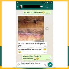 Gunakan pembalut bersalin atau jenis pembalut lainnya yang secara khusus dirancang untuk pemulihan pascapersalinan. Obat Pengering Luka Jahitan Luka Jahitan Pasca Melahirkan Luka Jahitan Operasi Dll Qnc Jelly Gamat Shopee Indonesia