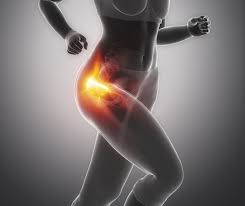 Image result for Snapping Hip