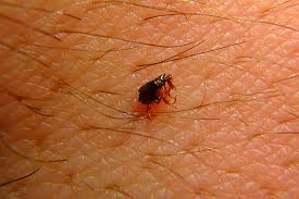 Maybe you would like to learn more about one of these? Puce 3 Trucs Pour Reconnaitre Une Infestation Extermination Complete