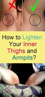 How To Lighten Your Inner Thighs And Armpits Lighten Inner Thighs Lighten Armpits Inner Thigh Darkness