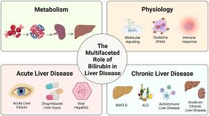 Image result for Maddrey Discriminant Function
