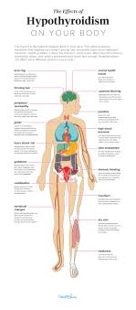 Effects Of Hypothyroidism Thinning Hair Heart Attack And More Effects Of Stress Chemotherapy Side Effects Hypothyroidism