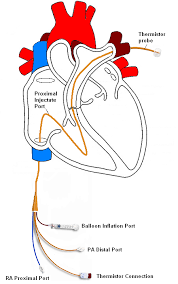 Swan Ganz Catheter Google Search Icu Nursing Critical Care Nursing Cardiac Nursing