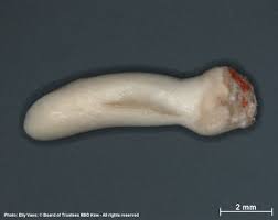 Image result for Rytigynia acuminatissima