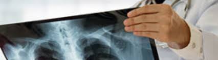 Maybe you would like to learn more about one of these? Mesothelioma Treatment Approved By Fda First In 15 Years