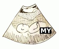 Learn the definition of unlockable. Baby Gender And Name Reveal Using Unlockable Content Nft On Unique One Dclick