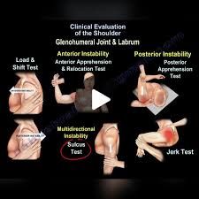 Image result for Shoulder Apprehension Test