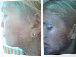 By staryes · april 26, 2017. Jennifer Esposito Plastic Surgery Before And After Celeb Surgery Com