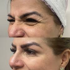 Dra. Norma Espinal. Md.Cirujano/ Md.Estetica