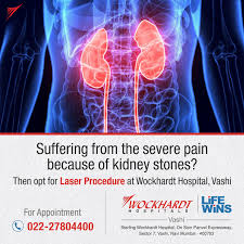 Kidney Stones Are More Common Among Males Than Females Most People Who Experience Kidney Stones Do So Between The Ages Of 30 And Hospital Kidney Stones Severe