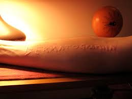 Image result for Dermatographism