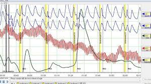Click the button for lie detector 100% free full practice test. Can You Beat A Lie Detector Test Bbc Future