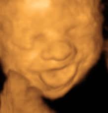 4d ultrasound pictures at 23 weeks. 3d Ultrasound Photos 23 Weeks 27 Weeks Baby Impressions 4d Greenville Sc