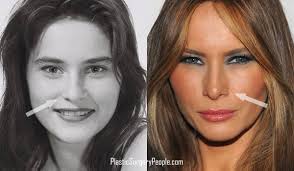 Claudia sierra is an interior designer in texas and . Did Melania Trump Have Plastic Surgery Before She Became Flotus