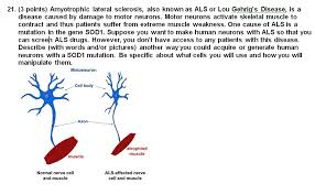 12 person with lou gehrig's disease. Solved 21 3 Points Amyotrophic Lateral Sclerosis Also Chegg Com