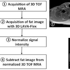 Flow Chart Of The Fatsubtracted Mra Technique Download