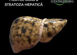 Exemplu de meniu și regim alimentar. Ficat Gras Si Steatoza Hepatica Poti Scapa De Ele In Cativa Pasi Simpli